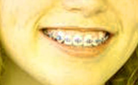 �������׵��������ӡ��x���600��