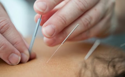 2017最新中醫(yī)針灸穴位歌訣大全