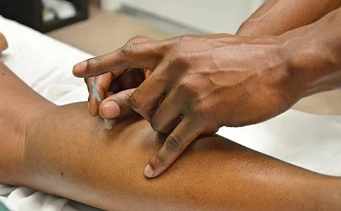 針灸實(shí)習(xí)心得體會(huì)